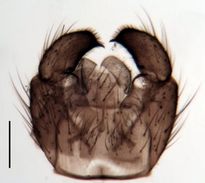 Figure 3. Trichosiopsis defecta male, hypopygium (Switzerland), scale 0.1 mm