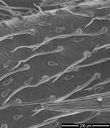 Zwei Typen von Haaren auf den Hülsen. Unten rechts die Spitze eines Kelchblattes. Die Basiszellen der langen Haare sind geschrumpft. (REM-Bild: K. Richert-Pöggeler, JKI)