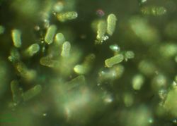 17. Mass  conidia formation. (Image by G. Pestsov)