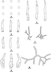 Figure 3. Microscopic structures of Scytinostroma beijingensis (from the holotype He 7768) a basidiospores b basidia c basidioles d, e gloeocystidia f skeletal hyphae from hymenium g skeletal hyphae from subiculum. Scale bars: 10 µm (a–g).