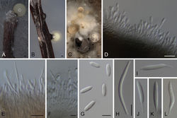 Figure 8. Diaporthe isoberliniaeA, B conidioma in PNAC conidiomata in OAD–F conidiophores and conidia G alpha conidia H beta conidia I–L Gamma conidia A, C, D–I STMA 18291 B, J–L STMA 18245. Scale bars: 100 μm (A, B); 500 μm (C), 10 μm (D, E), 5 μm (F–L).