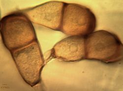 30. Narrowed to the bottom teliospores on the short stem (Image by G.V. Pestsov)/