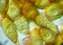 25. Oblongly-clavate, constricted teliospores of Puccinia allii (Image by G. Pestsov).