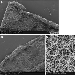 Figure 1. Cuatrecasanthus leaves: A Cuatrecasanthus lanceolatus showing projecting marginal tooth B Cuatrecasanthus kingii showing incurved tooth C Myceliform hairs on abaxial surface of leaf of Cuatrecasanthus giannasii.