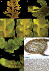 Figure 10. Radula australiana pictures. A Ventral view of shoot B Immature perianth. C–E Ventral view of shoots and lobules F Gynoecium G Androecium H Transverse sections of stems from primary shoot I Leaf-lobe marginal cells. A from CHR559976, all others from NSW875862.