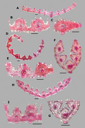 Figure 31. Leaf blade anatomy in transversal section of Agrostis species, in general view, and details of lateral bundles. A–CA. scabraD–EA. stoloniferaF–GA. subpatensH–IA. subrepens. Scale bars: 0.1 mm.