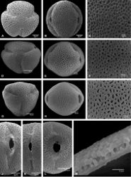 Figure 13. Pollen of Pseudocoptosperma and Tulearia. A–C, J Pseudocoptosperma menabense D–F, K Tulearia capsaintemariensis G–I, L, M T. splendida. A, D, G polar view B, E, H equatorial view C, F, I mesocolpium J–L ectoaperture M pollen grain wall. A–C, J Capuron 20569-SF; D–F, K Groeninckx et al. 309 G–I, L, M Capuron 20777-SF.