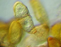 26. Puccinia allii  teliospore on the stem (Image by G. Pestsov).