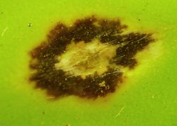 18. Puccinia allii teliospores breaking the epidermis (Image by G. Pestsov).