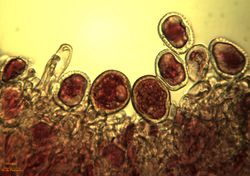 7. Puccinia allii urediniospores and paraphyses (Image by G. Pestsov).