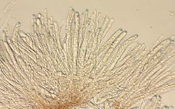 Figure 10. Asci with ascospores and paraphysis.