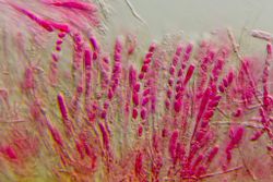 Figure 11. Asci with ascospores and paraphysis.