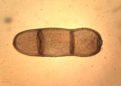 29. Septa of Heterosporium gracile conidia. (Image by G. Pestsov)