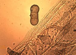 7. Submersed mycelium of Heterosporium gracile (Image by G. Pestsov)