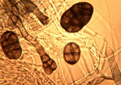 12.The phases of conidiophores and conidia formation.JPG (Image by G. Pestsov)