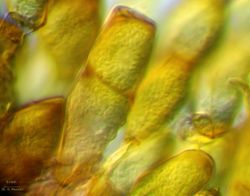 23. Truncated teliospores of Puccinia allii (Image by G. Pestsov).