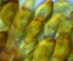 22. Various forms of Puccinia allii teliospores (Image by G. Pestsov).