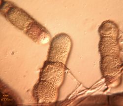 23. Verruculose surface of Heterosporium gracile conidia. (Image by G. Pestsov)