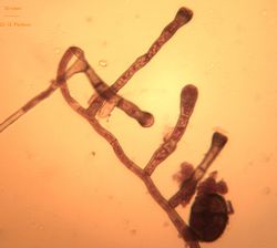 7.Young conidiphores formation.jpg (Image by G. Pestsov)