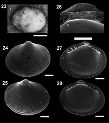 Figures 23–28. Microgloma pusilla (Jeffreys, 1879) USNM 199712 23 Microgloma nhanduti sp. n. External view, leftt valve 24 IBUFRJ 15283, right valve 25 IBUFRJ 14991. Internal view holotype MNRJ 19.113, detail of the reslifer and umbo 26 right valve 27 left valve 28 Scale bars: 23 = 500 µm; 26 = 100 µm; 24–25, 27–28 = 200 µm.