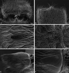 Figure 35. A–F Dresserus sp., female from Klein Kariba, South Africa (CASENT 9025745, CAS), scanning electron micrographs of prosoma. A anterior view, chelicerae removed, arrow indicates clypeal hood B dorsal view of eye region C fovea D sternum E right chelicera, ectal view F right cheliceral boss.