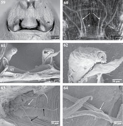 Figures 59–64. Internal anatomy of Trogloraptor marchingtoni, female (CASENT9040051) from No Name Cave. 59 vulva, dorsal view 60 female posterior respiratory system, tracheae and apodemes, with arrows to median apodemes61–64 Scanning electron micrographs of the internal anatomy 61 vulva, dorsal view, AT, atrium, RC, receptaculum 62 apex of right receptaculum 63 posterior respiratory system, dorsal view, with white arrow to median apodeme and black arrows to lateral tracheal branches; and 64 apex of apodeme (white arrow), note frayed end typical of muscle attachment. Booklungs removed from preparation in 59, 61 and 62.