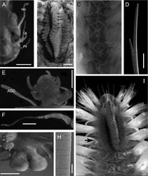Figure 2. Notopygos caribea sp. n. A Prostomium, dorsal view B Caruncle, arrow showing circular projection in the middle of the caruncle C Pigmentation pattern between chaetiger 9–12 D Notochaeta from chaetiger 10 E Branchia and accessory dorsal cirrus from chaetiger 15 F Main dorsal cirrus from chaetiger 15 G Distal lobes H Chaetal fragmentation I Anterior part of live specimen from Guana Island, BVI (photo: Leslie Harris), arrows showing branchiae beginning. Holotype: A, B, E–G, paratype: C, D, H. ADC accessory dorsal cirrus LA lateral antennae Li lips MA median antenna Pa palps. Scale bar: A, B, E-G= 0.5 mm, D= 100 μm.