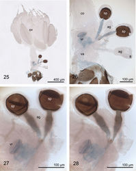 Figures 25–28. Internal female reproductive organs of Planinasus kotrbae sp. n., photos, left lateral view. 25 overview 26 vagina and associated organs 27 ventral receptacle and spermathecae 28 same, different focal plane. ag accessory gland co common oviduct ft fatty tissue ov ovaries sp spermatheca, slightly cracked and distorted in the microscopic slide preparation va vagina vr ventral receptacle.