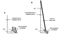 Figure 92. Configuration of jaw articulation and long axis of the lower jaw in Heterodontosaurus tucki from the Lower Jurassic Upper Elliot and Clarens formations of South Africa. Diagrammatic depiction of jaw configuration based on subadult skull AMNH 24000 and adult skull SAM-PK-K1332 A Left quadrate condyles in anterior view showing 30° angle from the horizontal B Left quadrate condyles and long axis of the lower jaw in ventral view showing 40° angle from a transverse axis and 10° divergence from the midline, respectively.