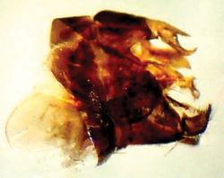 Figure 3. Male genitalia of Anthrax alruqibi El-Hawagrysp. n.
