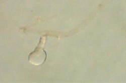 Figure 4. Spermatheca of female Anthrax alruqibi El-Hawagrysp. n.