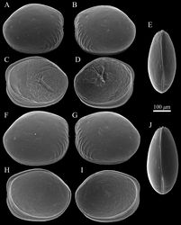 Figure 2. SEM images of Polycopetta quadrispinata sp. n. valves. A and B male paratype (SUM-CO-2095) C and D male, paratype (SUM-CO-2096) E male, paratype (SUM-CO-2097) F female, paratype (SUM-CO-2105) G female paratype (SUM-CO-2106) H and I female, paratype (SUM-CO-2107) J female, paratype (SUM-CO-2108). A right external lateral view B left external lateral view C right internal lateral view D left internal lateral view E dorsal view F right external lateral view G left external lateral view H right internal lateral view I left internal lateral J dorsal view.