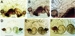 Figure 17. Ventral view of epigynes of Acanthinozodium niusha sp. nov. (A–C) and A. parysatis sp. nov. (D–F). Scale bar: 0.2 mm, unless stated otherwise.