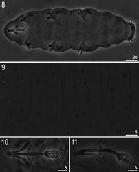 Figures 8–11. Minibiotus formosus sp. n.: 8 habitus (holotype, ventral view) 9 dorsal cuticle with pores (holotype) 10–11 bucco-pharyngeal apparatus (10 dorso-ventral projection, paratype 11 lateral view, paratype). All PCM.
