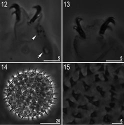 Figures 12–15. Minibiotus formosus sp. n.: 12 leg II with claws, granulation (arrowhead) and a single large pore (arrow) (holotype) 13 claws IV (paratype) 14 egg (mid-section) 15 egg surface with processes. All PCM.