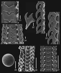Figures 21–27. Jerrybuccinum kantori sp. n. 21–24 radula of paratype 1, scalebar: 10 micrometer 25 statocyst of paratype 1, scalebar: 100 micrometer 26 radula of Jerrybuccinum explorator, scalebar: 100 micrometer. 27 radula of Jerrybuccinum malvinense, scalebar: 100 micrometer, after Kantor & Pastorino, 2009: fig. 11.