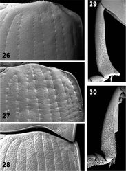 Figures 26–30. Elytral disc (26, 27, 28); male mesotibia (29); male protibia (30). Monodius gravis (26, 29, 30), Ectateus calcaripes (27), Ectateus lamottei (28).