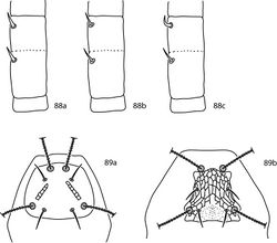 Figures 88, 89. Pseudobonzia key illustrations 88a Pedipalp basifemur and telofemur with spine-like setae on both segments 88b Pedipalp basifemur and telofemur with simple setae on both segments 88c Pedipalp with simple seta on basifemur, spine-like seta on telofemur 89a Proterosomal plate convex posteriomedially 89b Proterosomal plate not convex posteriomedially.