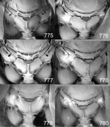 Figures 775–780. Euplectrus spp., propodeum, females: 775 Euplectrus pammitchellae (DHJPAR0038580) 776 Euplectrus paulhansoni (DHJPAR0028775) 777 Euplectrus paulheberti (DHJPAR0053133) 778 Euplectrus paulhurdi (DHJPAR0028878) 779 Euplectrus philwardi (DHJPAR0028876) 780 Euplectrus robbinthorpi (DHJPAR0023276).