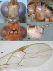 Figures 27–31. Canalirogas eurycerus sp. n., female, holotype. 27 head anterior 28 mesosoma lateral 29 head dorsal 30 hypopygium lateral 31 apical part of fore wing.