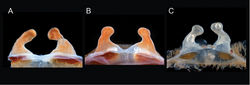 Figure 66. Aphonopelma iodius (Chamberlin & Ivie, 1939). A–C cleared spermathecae A AUMS_2386 B AUMS_3310 C angusi allotype.