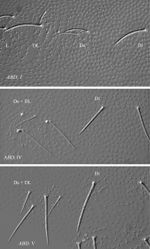 Figure 6. Ectonura barrai sp. n.; chaetal groups and faint tubercles Di, De and DL on Abd I, Abd. IV and Abd. V.