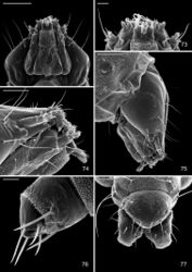 Figures 72–77. Late tissue feeding instar larva of Macrosaccus robiniella. 72 Head, ventral view (100 µm) 73 Detail of mouthparts, ventral view (20 µm) 74 Lateral view of mouthparts (50 µm) 75 Lateral view of head (100 µm) 76 Thoracic leg (20 µm) 77 Abdominal segments 9, 10, dorsal view (100 µm). (Scale lengths in parentheses).